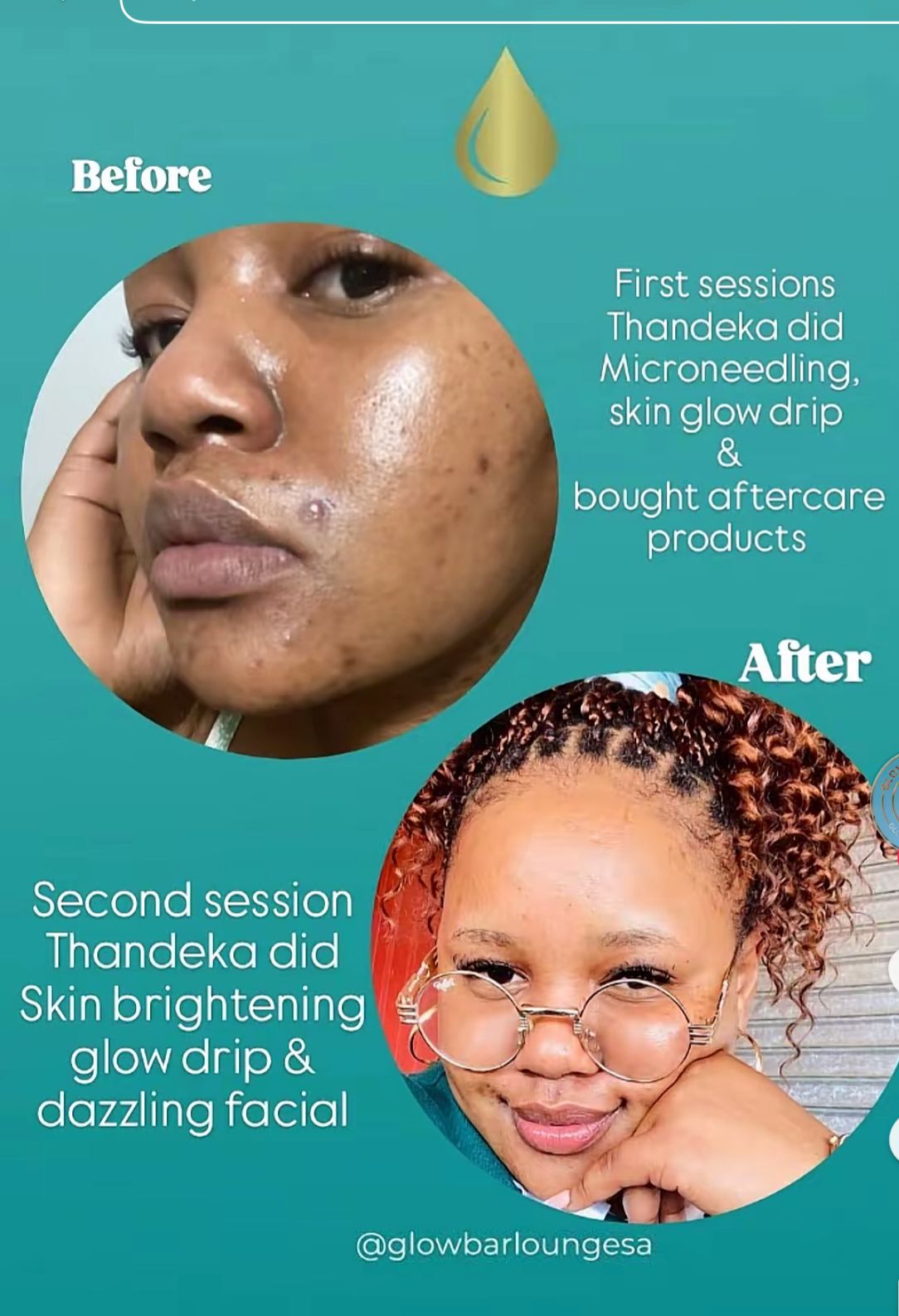 Real client results — before and after Glow Bar Lounge treatment